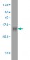 HFE Antibody (monoclonal) (M01)
